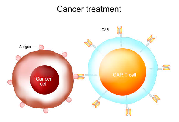 fda-alerts-public-to-cancer-risk-associated-with-car-t-therapy-a-promising-blood-cancer-treatment